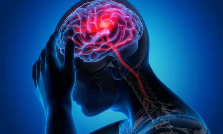 Les maux de tête : un guide clair et concis
